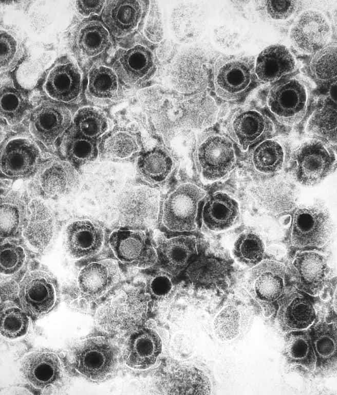 herpes simplex virus which can be carried by hedgehogs and humans